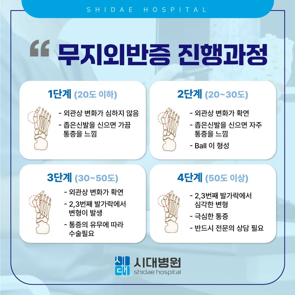 시대병원 무지외반증 진행과정 안내